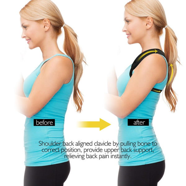 Clavicle Posture Corrector